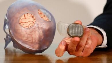 32-yr Patient Receives Microchip Implanted in His Brain