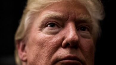 White House says Trump Diagnosed with Vein Condition after Questions About Bruises